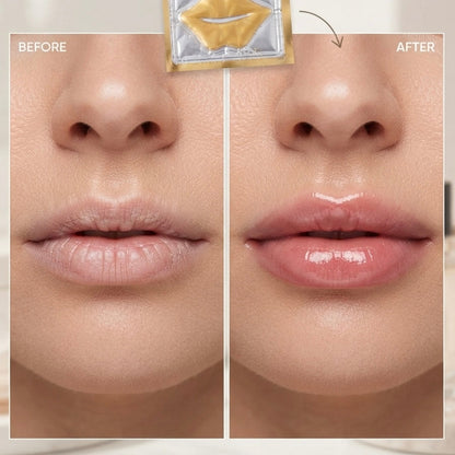 Lip Treatment Mask (4 pack)