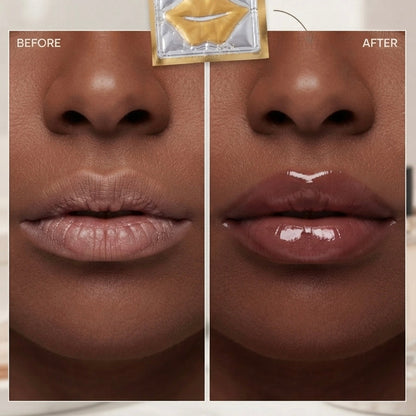 Lip Treatment Mask (4 pack)